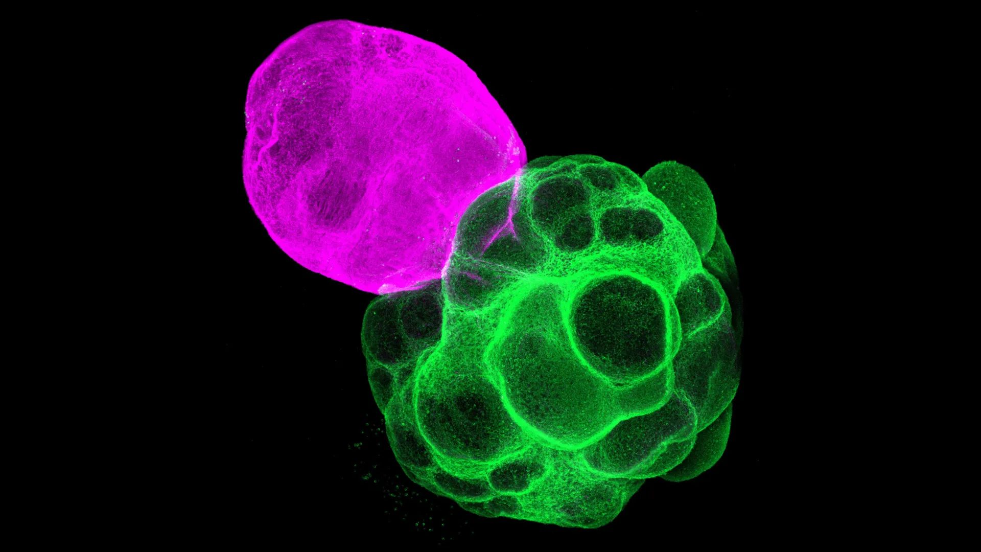Cientistas japoneses acabam de construir circuitos cerebrais humanos em laboratório.